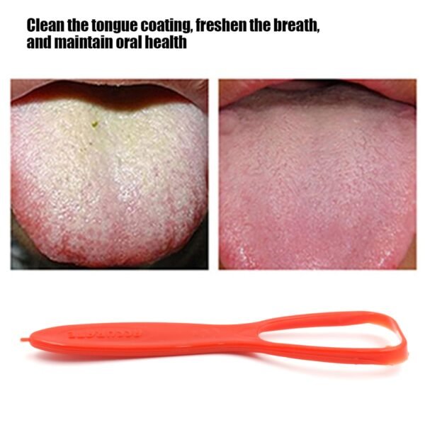 Plastic Tongue Cleaner For Kids & Adults | Tongue Scraper For Bad Breath, Maintain Oral Hygiene for Daily Use | for Fresh Breath & Bacteria Removal | Improved Taste Plastic With Handle Tongue Cleaner (1 Pc ) - Image 5